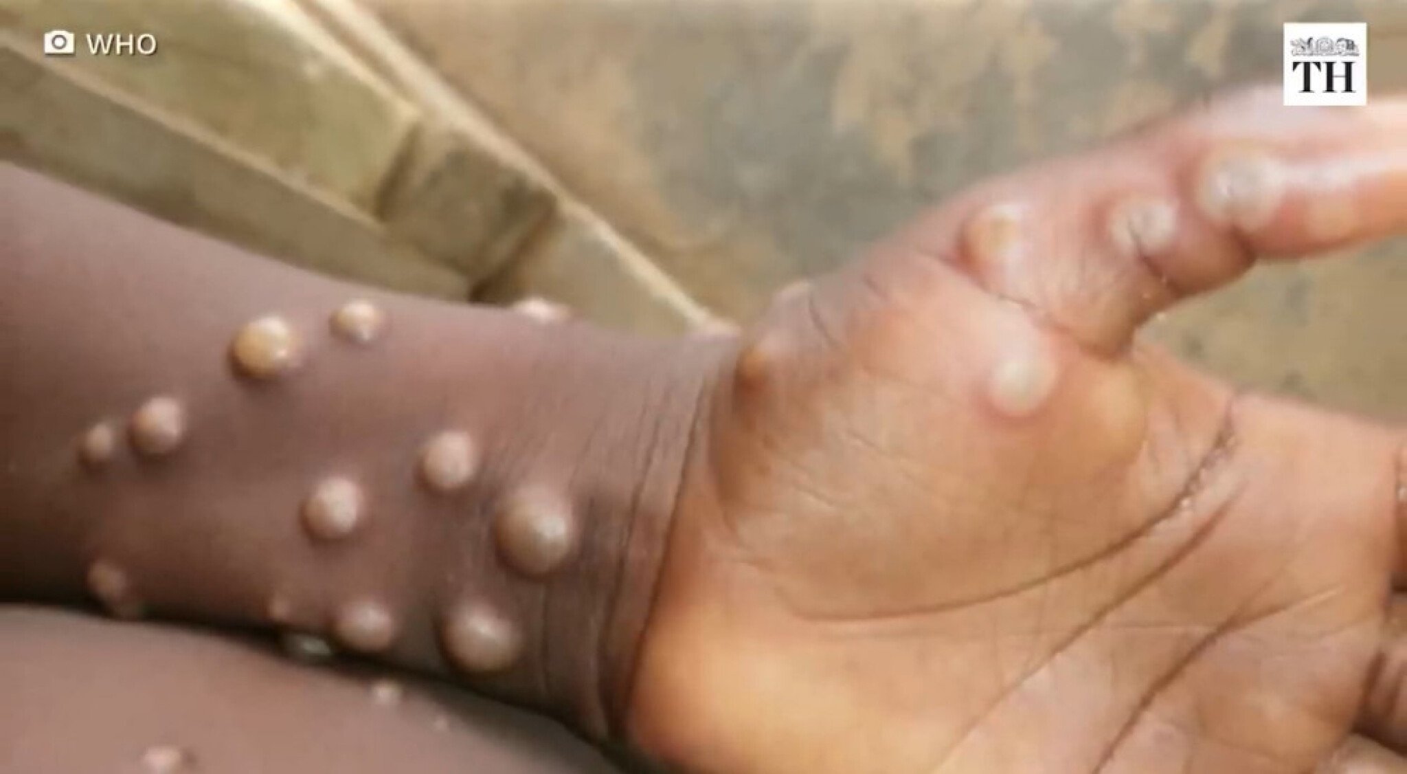 unguq1uqvfhqjvyzjmn8