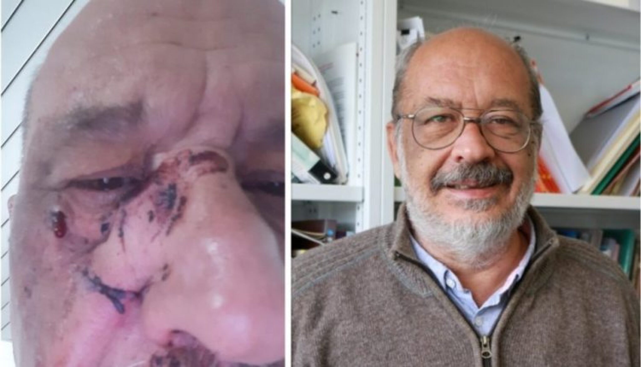 ilija-casule-960x573-1-750x430