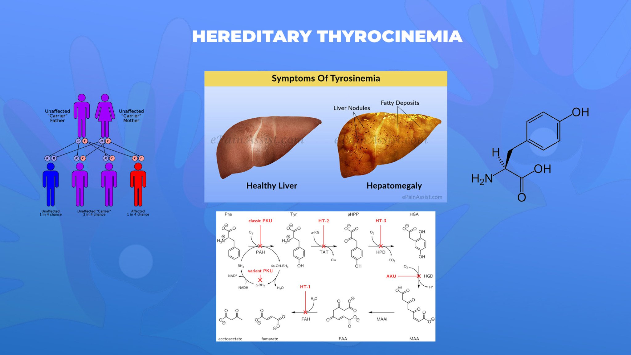 03-Hereditary-Thyrocinemia