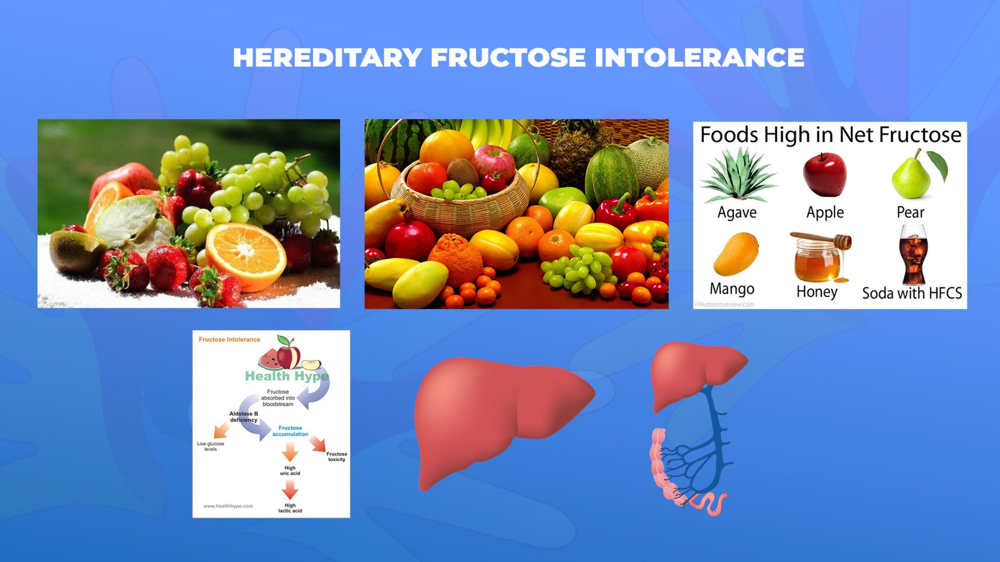 02-Hereditary-Fructose-Intolerance