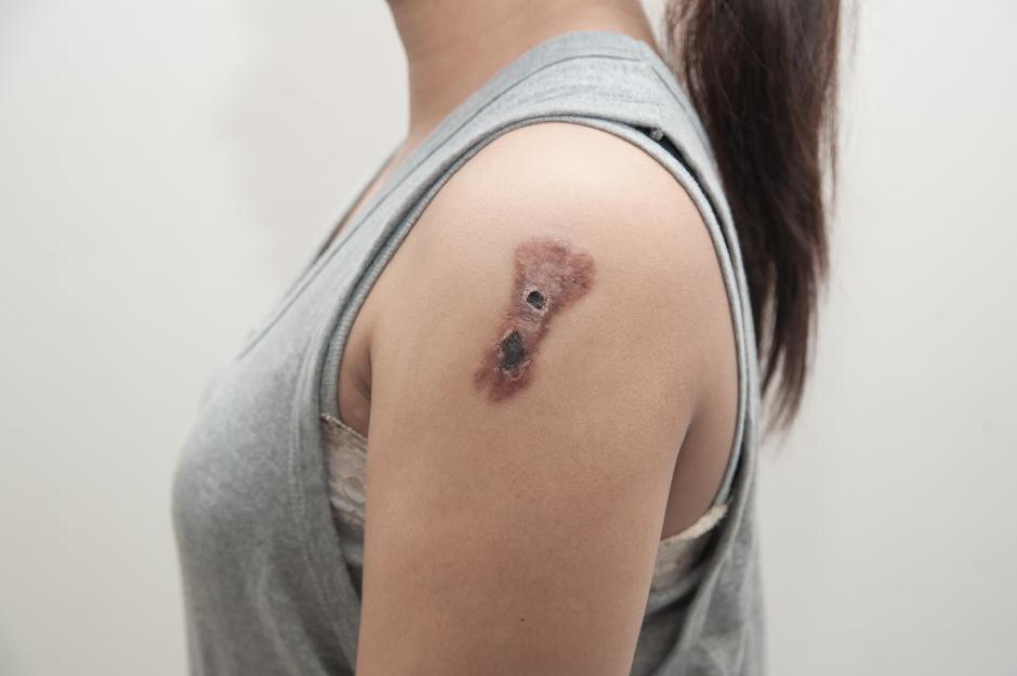 635b11926d5a6d74fc6c