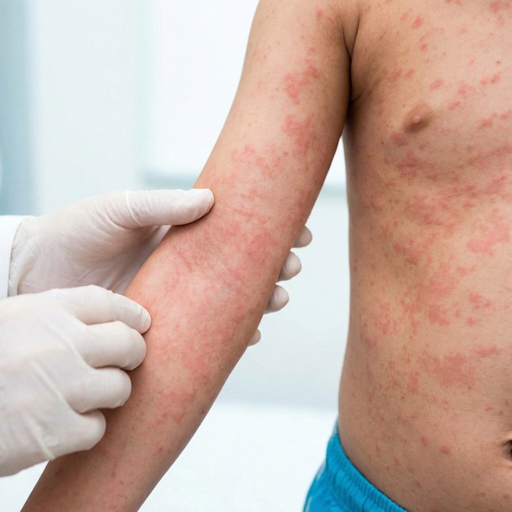 media-libraryfe1c2cbnurfq5Yw7Tp0